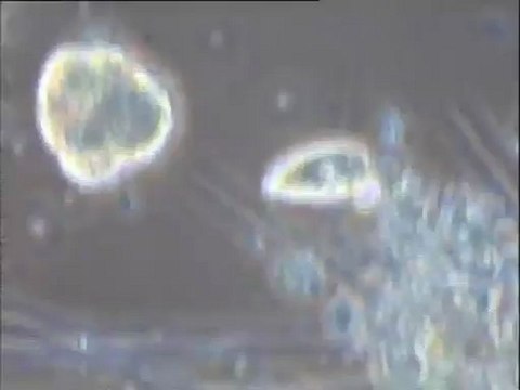 Examen de deux boues activées de provenance indéterminée au microscope : examen de la boue BR8