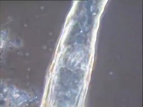 Examen des boues activées de la station de l'usine Motta : observation des mousses sur bassin