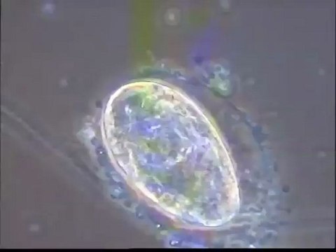 Observation de rotifères et de leurs oeufs sur la boue activée venant de la station de Motta