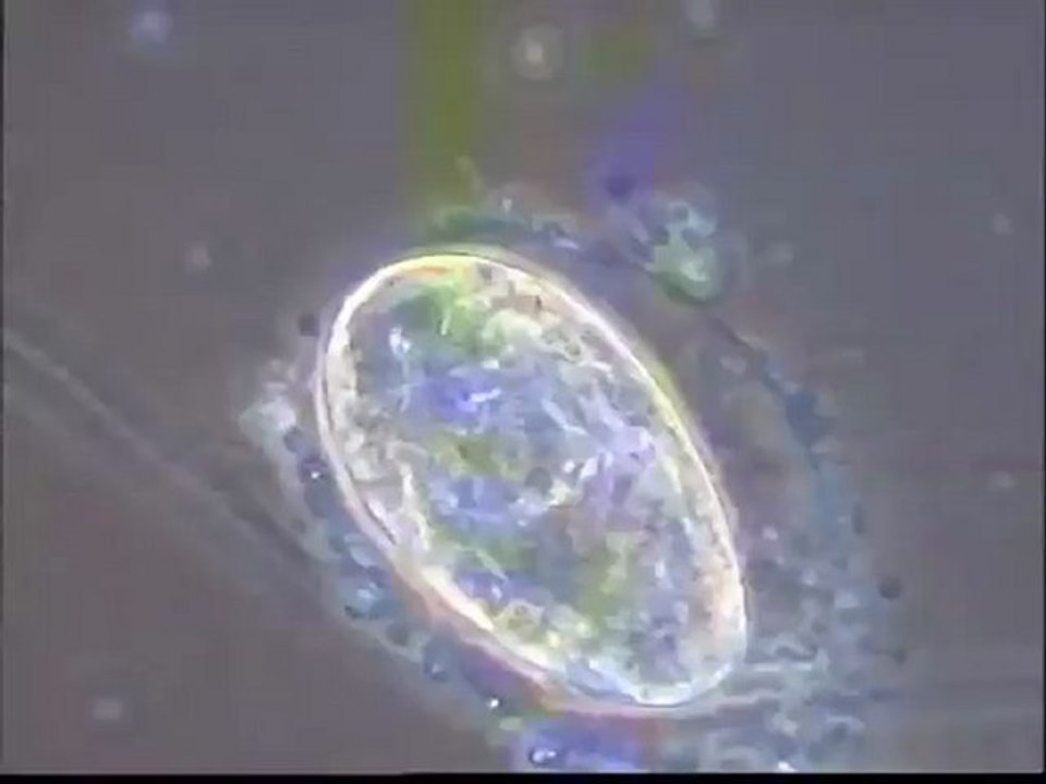 Observation de rotifères et de leurs oeufs sur la boue activée venant de la station de Motta