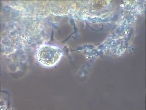 Observation d'une boue activée de la file est de la station de Versailles