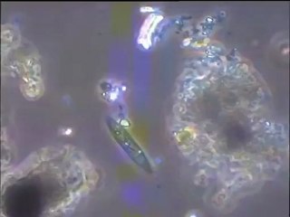 Examen du sédiment de l’étang de Saint-Quentin-en-Yvelines