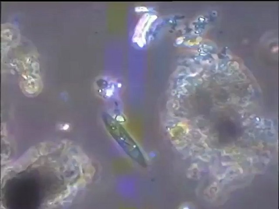 Examen du sédiment de l’étang de Saint-Quentin-en-Yvelines