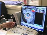 Cardiac Catheterization Lab (Heart Cath)