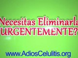 celulitis en abdomen - crema contra celulitis - piernas con celulitis