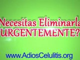 mujeres con celulitis - eliminar celulitis gluteos - remedios contra celulitis