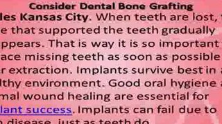 Snap on Smiles Kansas City - Dental Bone Grafting