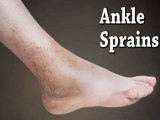 Ankle Sprains - Podiatrist in Valley Stream and Lake Success, NY