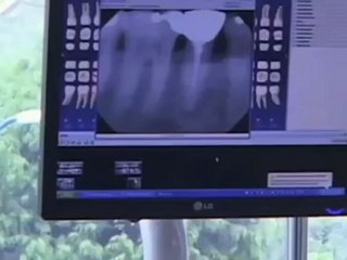 Trevisani Oral Surgery: Offers Excellent IV sedation  ...