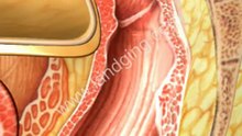 Digestive System Animation: Hemorrhoids