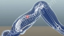 Accident Animation | Sports Injury - Yoga
