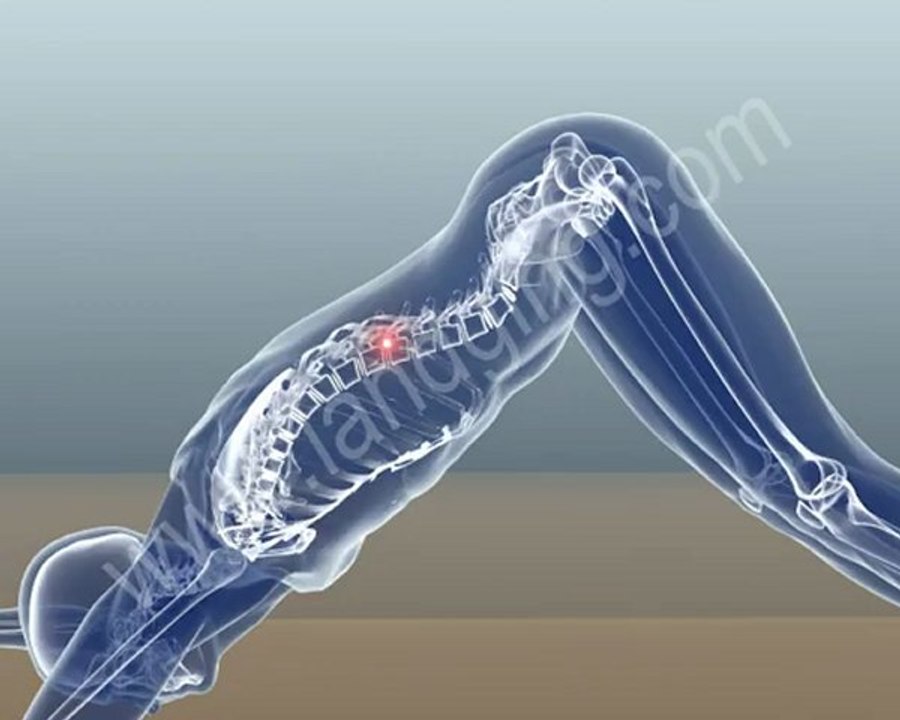 Accident Animation | Sports Injury - Yoga