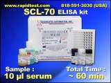 SCL-70 ELISA kit