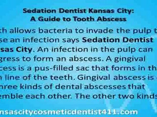 Sedation Dentist Kansas City a Guide to Tooth Abscess
