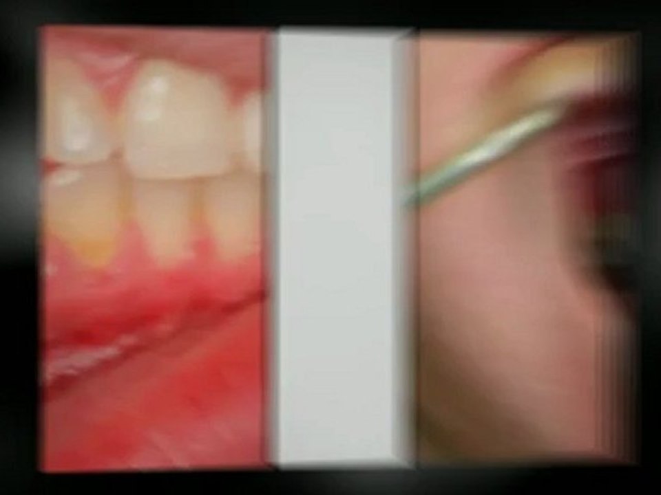 Dental Implants Detroit