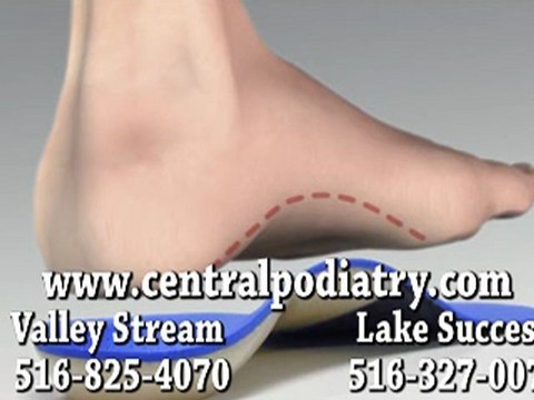 Custom Orthotics - Podiatrist, Valley Stream and Lake Success, NY
