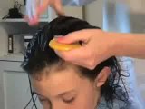 How To Remove Head Lice | (914) 424-1367 | DML Lice Removal Services