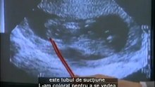 The Silent Scream _ Strigătul mut (Romanian subtitles)