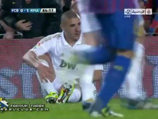 إصابة كريم بنزيما امام برشلونة