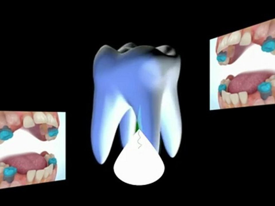 Tooth Regeneration