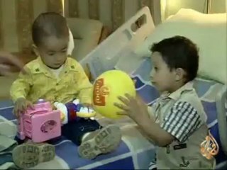 طبيب إماراتي يحرز سبق جراحي عالمي