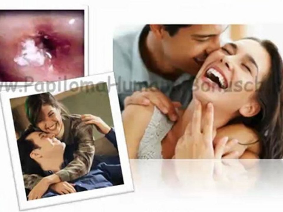 TRATAMIENTO PARA EL VIRUS DEL PAPILOMA HUMANO EN MUJERES