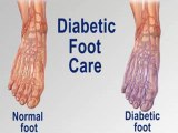 Diabetic Foot Care - Podiatrist in Monroe, Chester and Central Valley, NY