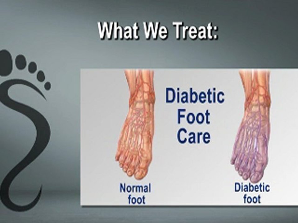 Laura Piluso, DPM - Podiatrist in Monroe, Chester, Central Valley, NY