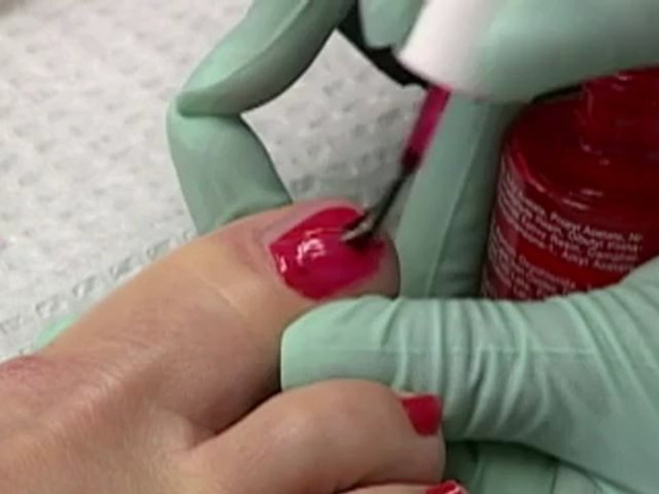 Nail Restoration for Toenail Fungus - Podiatrist in Valley Stream and Lake Success, NY