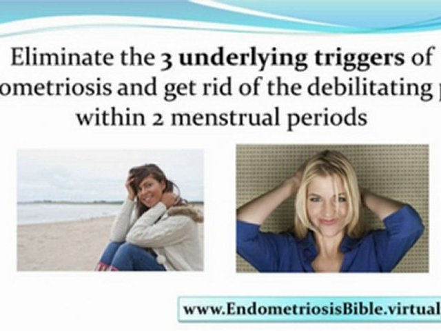 endometriosis treatment options – treatment of endometriosis