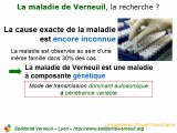 La maladie de verneuil