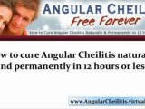 angular cheilitis treatment - angular cheilitis