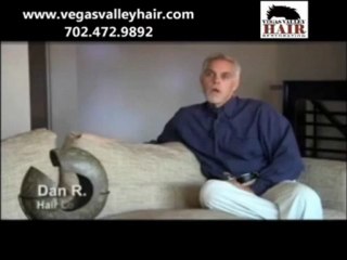 Hair Replacement Cost Salt Lake City UT