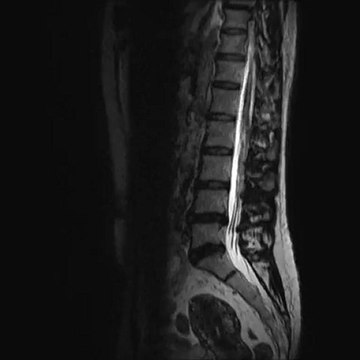 Ciné _Argus RL - Ostéo Articulaire par le service de Radiologie Lyon Nord