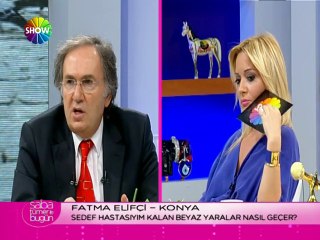 Prof. Dr. İbrahim Saraçoğlu - Sedef hastalığında beyaz yaraların geçmesi için kür