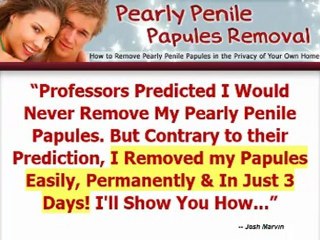 Pearly penile papules home remedies