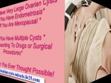 ovarian cysts that burst - ovarian cysts rupture symptoms - about ovarian cysts