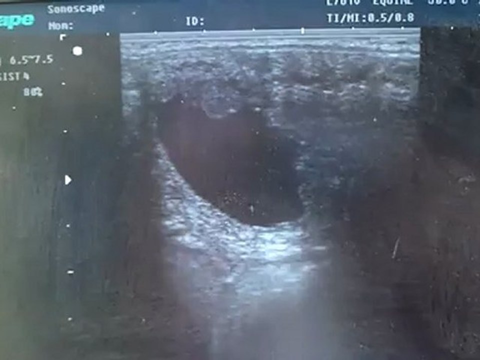 1ère échographie El Qahirah