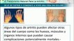 Que es la Artritis - síntomas y causas