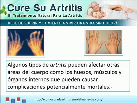 Que es la Artritis - síntomas y causas
