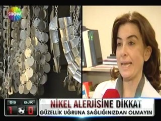 Nikel alerjisine dikkat - 06 mayıs 2012