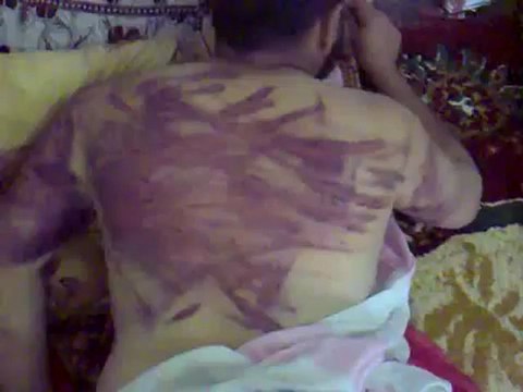 فري برس إدلب بلدة الهبيط أثار التعذيب لاحد المواطنين من قبل جيش الاحتلال الاسدي Idlib