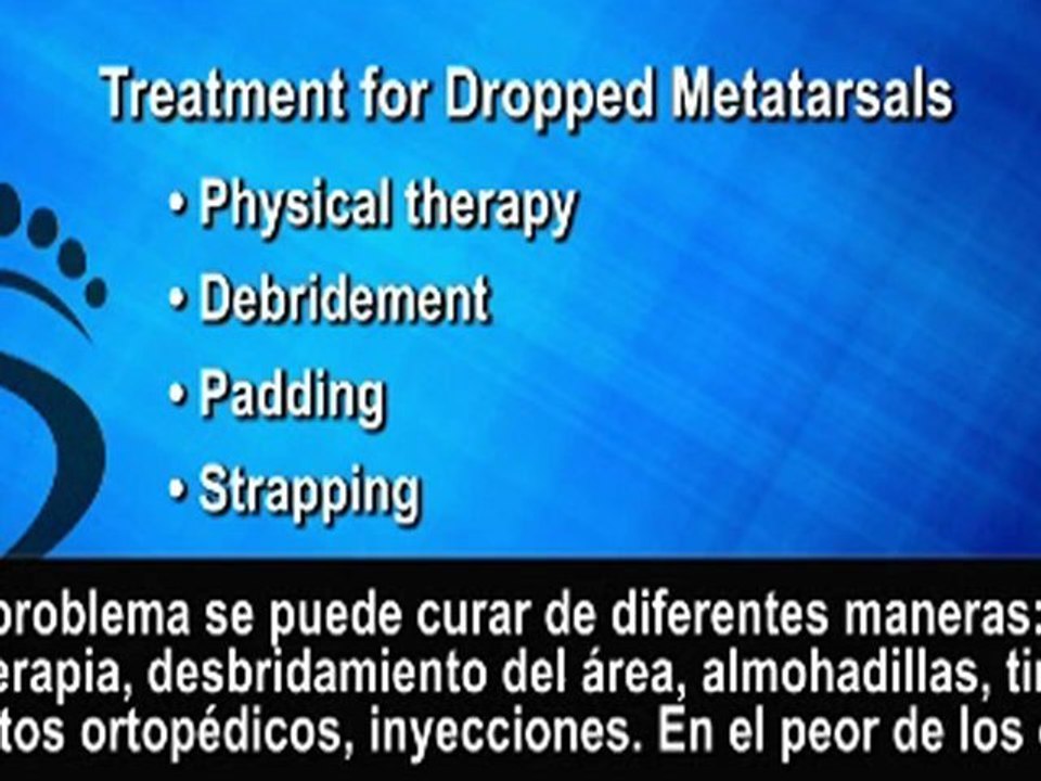 Metatarsos Caídos (Dolor en la Planta del Pie) - Podólogo - NYC Manhattan y White Plains, NY