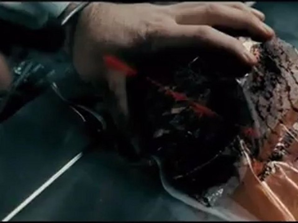 Repo Men - Clip - What Have You Got?
