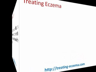 atopic eczema treatment