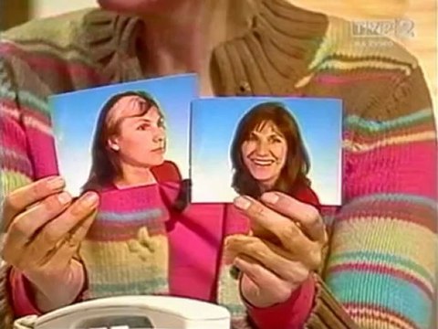 Wypadanie włosów przyczyny