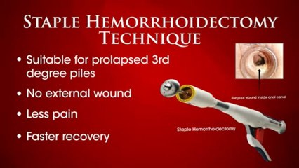 DrNYWong-piles-colorectal-surgery