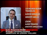 Burun tıkanıklığında sebepler ve çözüm yolları - Op.Dr.Muhammet DİLBER