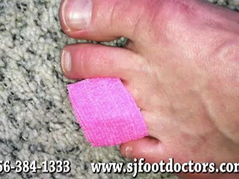 Foot and Ankle Fractures - Podiatrist - Cherry Hill, Voorhees and West Deptford, NJ