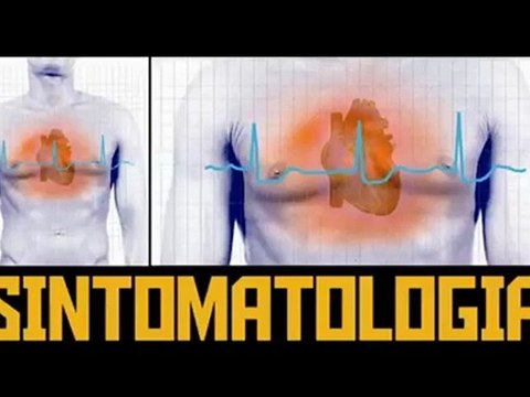 Saber Vivir: Causas y consecuencias de la insuficiencia cardíaca